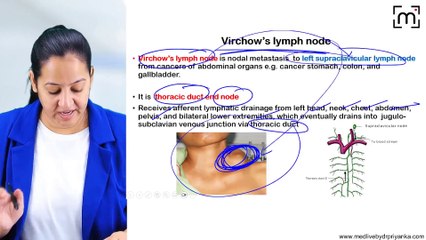 4. Spread of Tumours