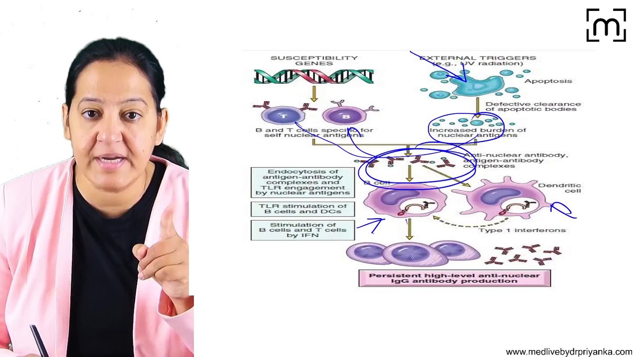 4. Systemic Lupus Erythematous