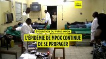 L'épidémie de variole due au virus Mpox continue de se propager