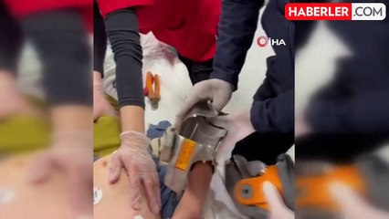 2 Yaşındaki Çocuk Kıyma Makinesine Elden Kaptırdı