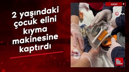 Hatay'da 2 yaşındaki çocuk elini kıyma makinesine kaptırdı