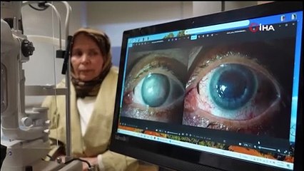 ‘Asla göremezsin' denilen kadın, Türkiye'de farklı göz rengiyle aydınlığa kavuştu