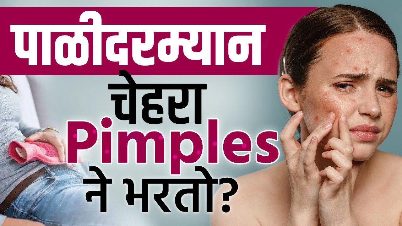 पाळीदरम्यान चेहऱ्यावर Pimples येऊ नये म्हणून काय करावं? How To Prevent Pimples | Skincare