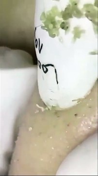 ASMR HEAVEN! Blackhead Extraction & Relaxing Facial [sacdepspa]