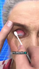 Des lentilles dans l’oeil