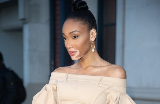 Winnie Harlow is engaged to NBA star Kyle Kuzma