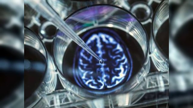 Las mujeres tienen mayor riesgo de padecer Alzheimer