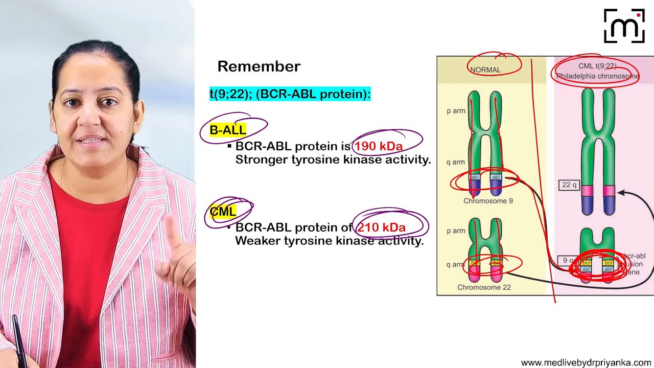 6. Acute Lymphoblastic Leukemia (ALL)