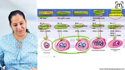10. Hodgkin's Lymphoma