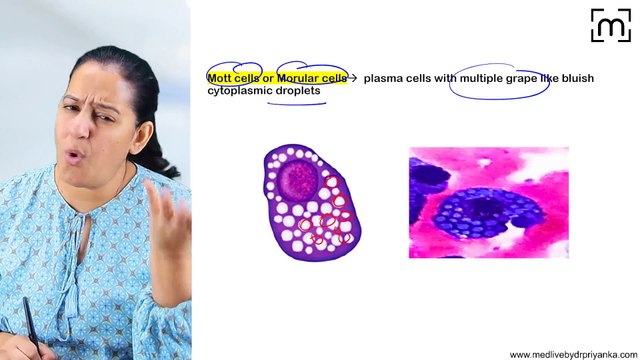 12. Plasma Cell Disorders- Multiple Myeloma