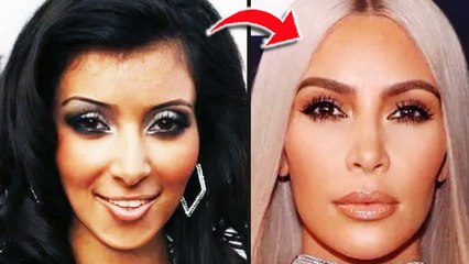 The Kardashians Have Changed Their Faces So Much
