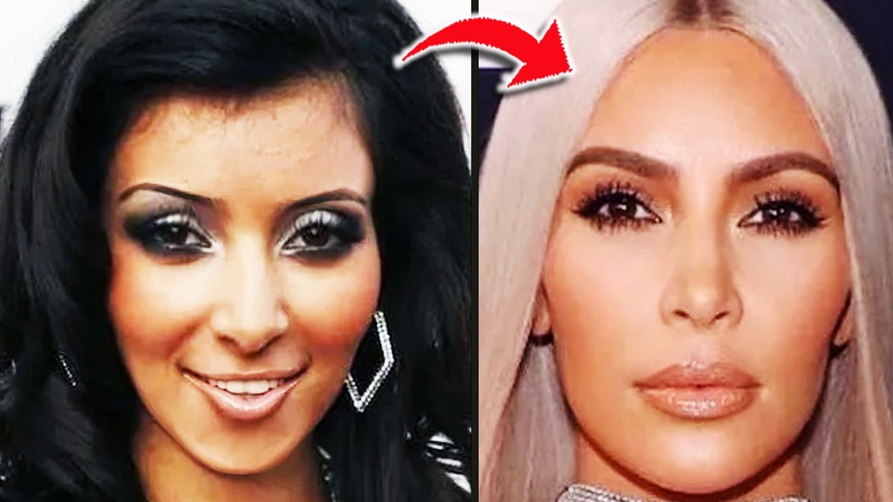 The Kardashians Have Changed Their Faces So Much