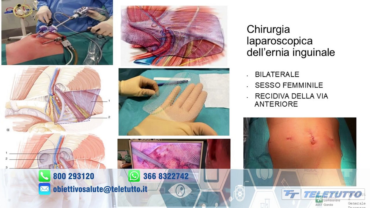 Obiettivo salute - Chirurgia addominale