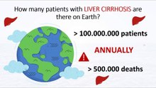 How many patients with liver cirrhosis are there on Earth?