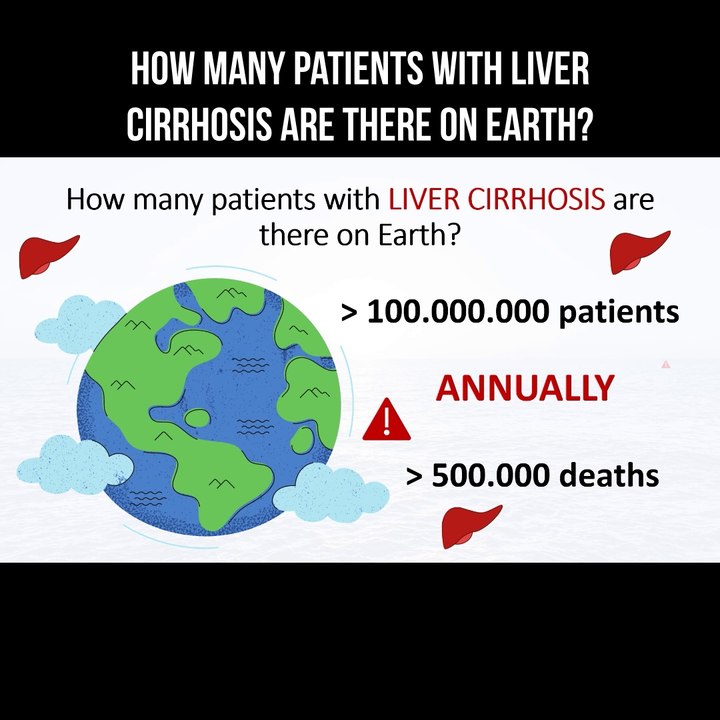 How many patients with liver cirrhosis are there on Earth?