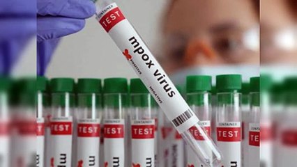 Desde abril no se registran casos de viruela símica en RD