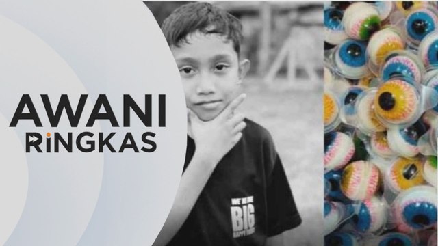 AWANI Ringkas: 'Gummy' mata - Jabatan Kesihatan Pulau Pinang siasat