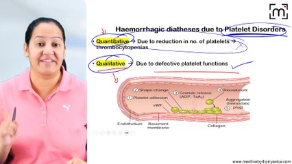 3. Functional Platelet Disorders Bernard Soulier Syndrome Glanzmann's