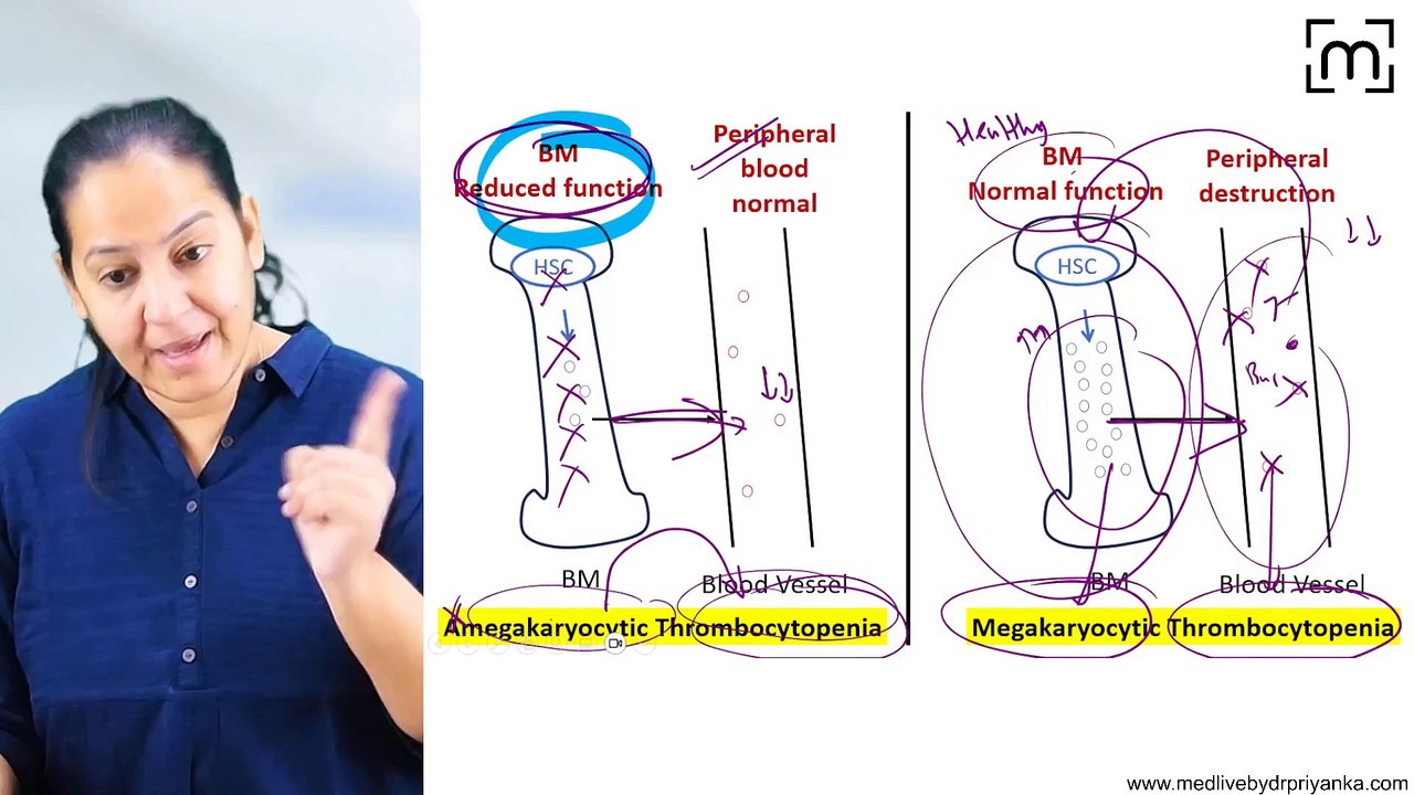 2. Thrombocytopenia (ITP, TTP &HLS)