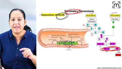 4. Coagulation Disorders_Hemophilia &Von williebrand's Disease