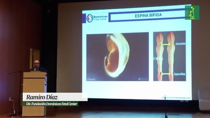 Realizan la primera cirugía de espina bífida intrauterina en República Dominicana