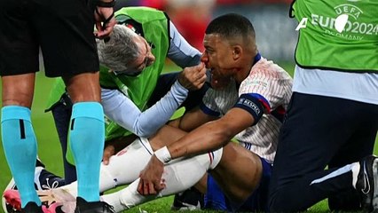 Kylian Mbappé sufre una fractura en la nariz