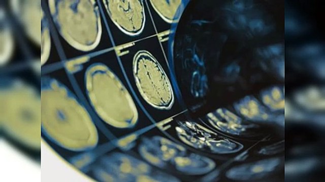 Día Internacional de los Tumores Cerebrales