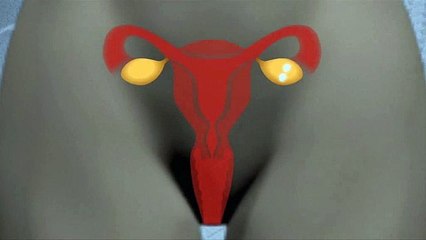 La fecundación in vitro