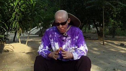 Los albinos buscan seguridad en la isla tanzana de Ukerewe