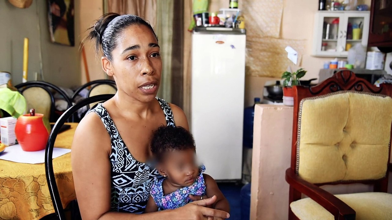 Labio leporino y paladar hendido