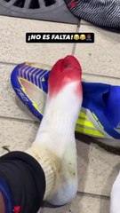 Lamine Yamal muestra la herida de su pie tras recibir un pisotón