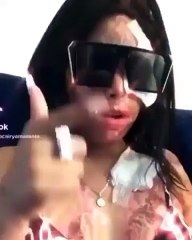 Yocairi Muestra Su Rostro Quemado  Mientras Interpretando Tema Urbano