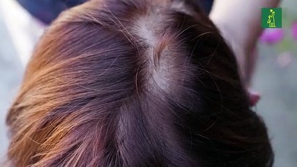 Nuestra salud: Cómo disminuir la caída del cabello durante la lactancia