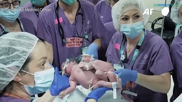 Médicos israelíes logran separar a gemelas de 1 año unidas por la cabeza