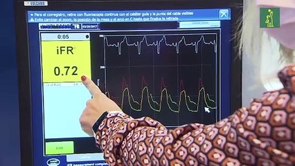 Innovaciones en cardiología intervencionista son presentadas en el CSC
