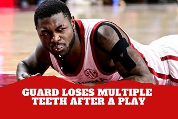 A brutal hit! Oklahoma Sooners guard loses multiple teeth after diving for a loose ball