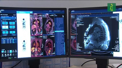 Pacientes con cáncer ven reducidas sus posibilidades de curarse con la llegada del Covid
