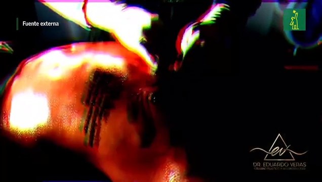 Así quedó el six-pack de El Mayor Clásico tras someterse a cirugía estética