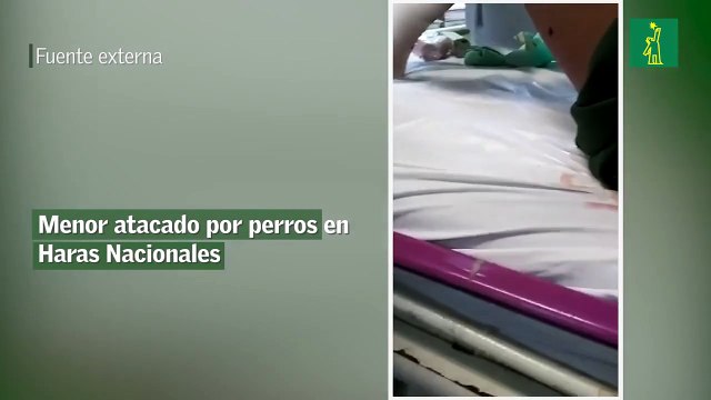 Menor atacado por perros en Haras Nacionales