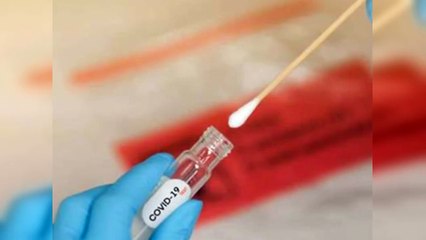 Solo 17 pruebas COVID-19 resultaron positivas en la última semana