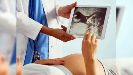 Mielomeningocele: Estudio revela mutación genética