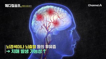세계 곳곳에서 3초에 1명씩 치매 진단을 받는다고?!♨♨ 치매 발병률이 높은 이유는?