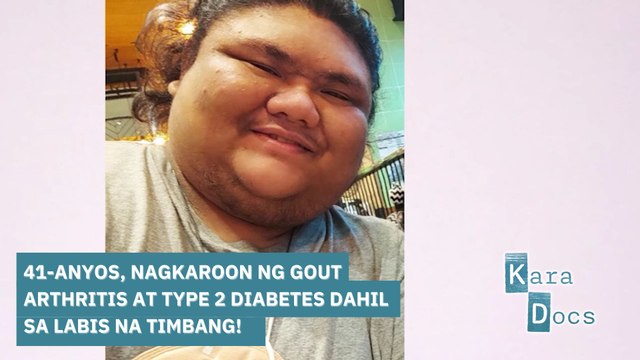41-anyos, nagkaroon ng gout arthritis at type 2 diabetes dahil sa labis na timbang! | Kara Docs
