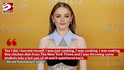 Joey King's chin is 'healing up nicely' after she suffered an accidental burn