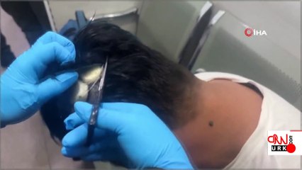 Akılalmaz yöntem! Zehir bakın nereden çıktı... | Video Haber