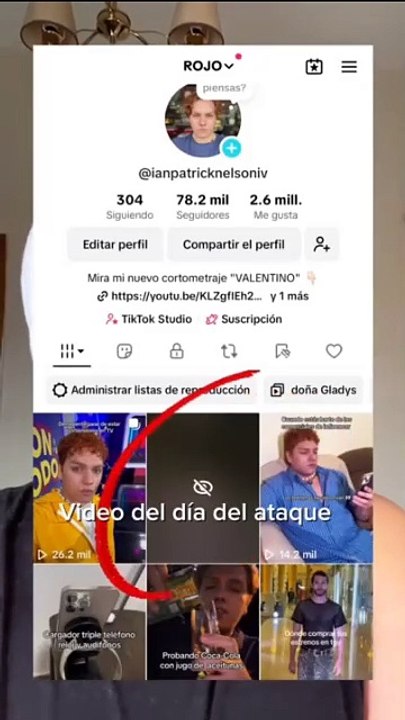 Influencer hondureño Patrick Nelson denuncia brutal agresión física