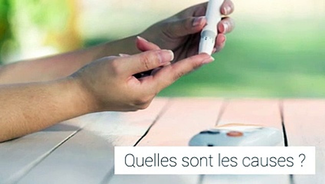 Le syndrome du canal carpien