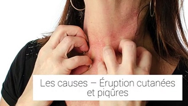 Que faire en cas de démangeaisons ?