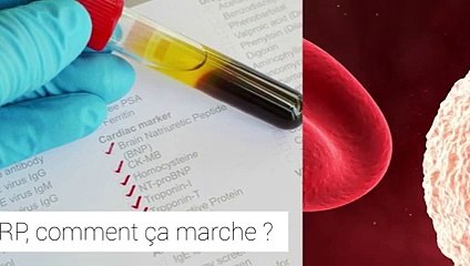 La protéine C-Réactive (CRP)