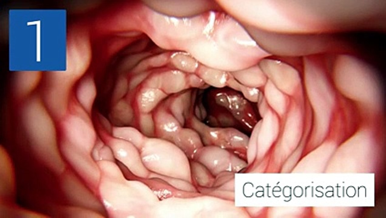 Réponses sur les troubles digestifs
